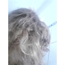 aloaps